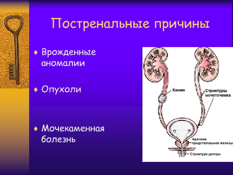 Постренальные причины Врожденные аномалии  Опухоли    Мочекаменная болезнь